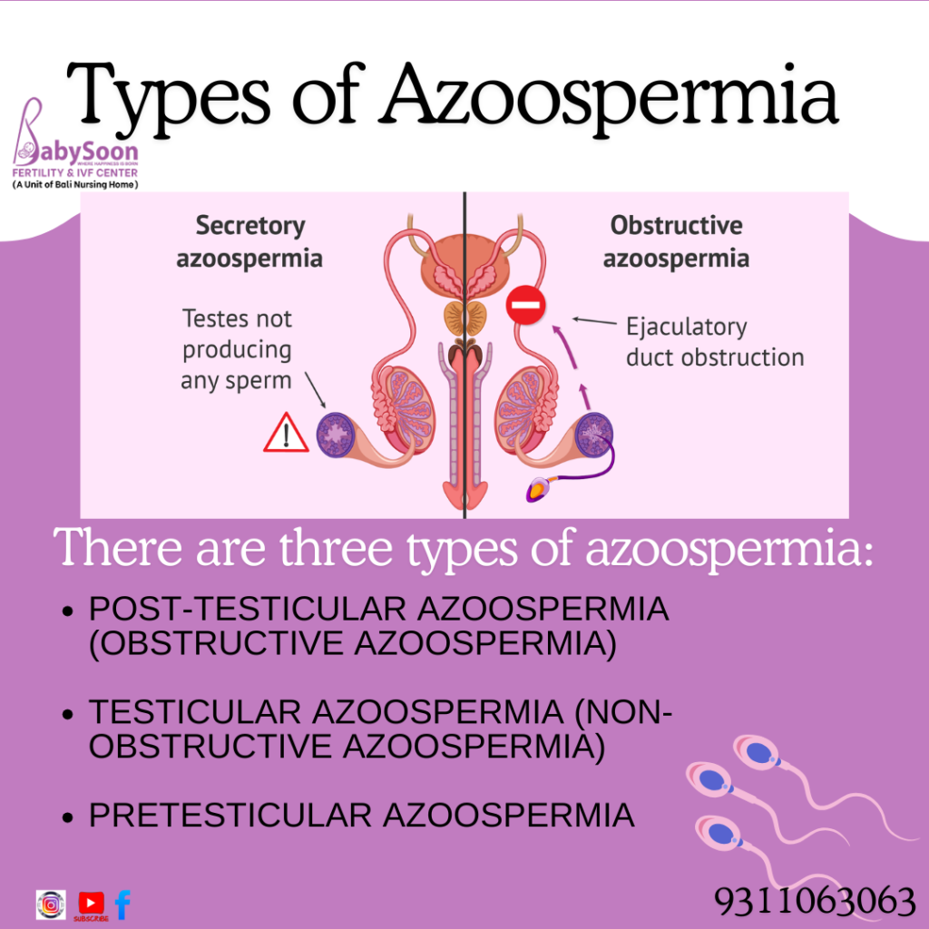 Types of Azoospermia Explained: Causes and Treatments